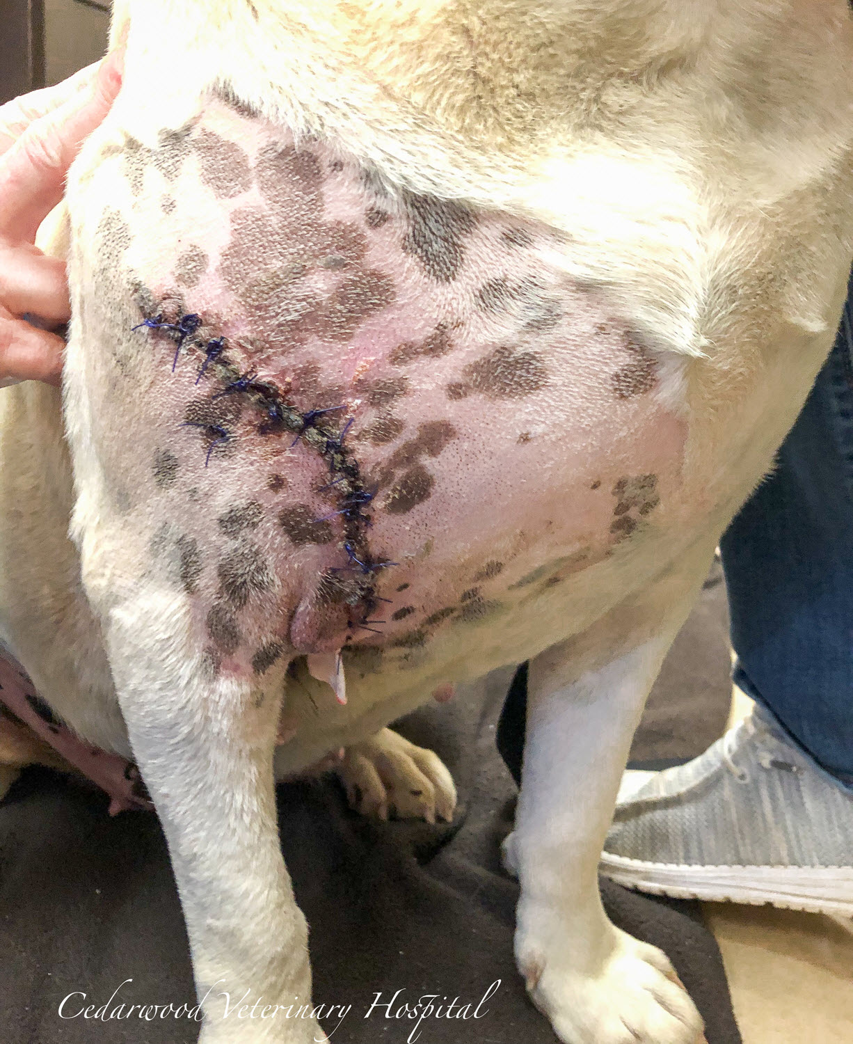 Wound was debrided, drain placed and sutured