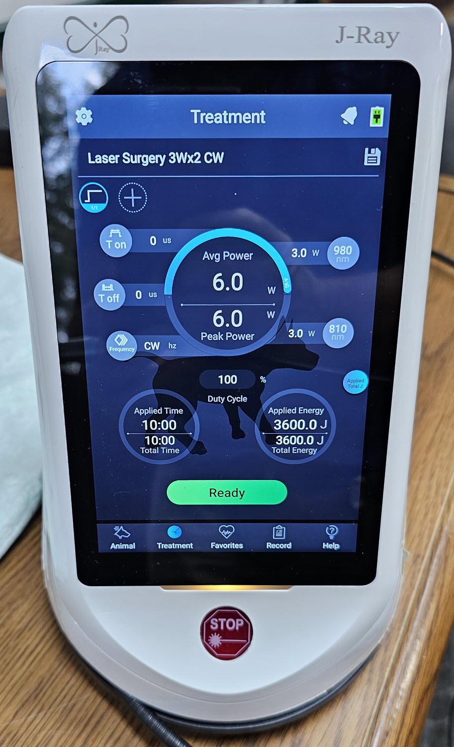 The settings on the J-Ray Laser for surgery